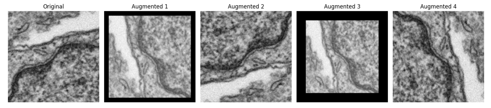 exemple d’augmentation d’images